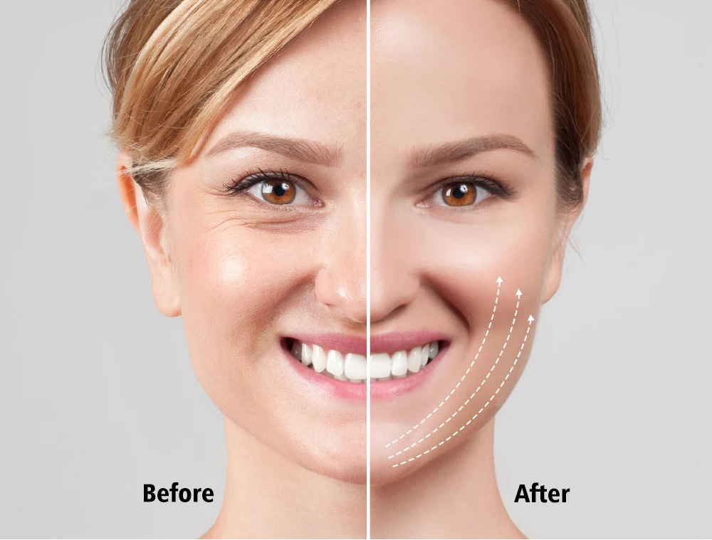 Ceinture de lifting du visage